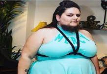 इस लड़की की निकल आती है दाढ़ी, बोली पहले रोज शेव करती थी अब इनके साथ खूबसूरत दिखती हूं