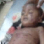 CG में बच्चे पर लकड़बघ्घे ने कर दिया हमला, इलाज के दौरान हुई मौत