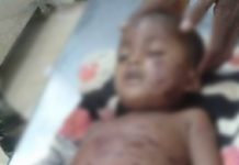 CG में बच्चे पर लकड़बघ्घे ने कर दिया हमला, इलाज के दौरान हुई मौत