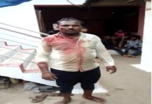 ब्रेकिंग: छत्तीसगढ़ में दो समुदायों के बीच हुई झड़प, 1 की मौत, चार घायल