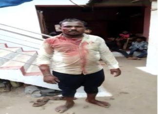 ब्रेकिंग: छत्तीसगढ़ में दो समुदायों के बीच हुई झड़प, 1 की मौत, चार घायल