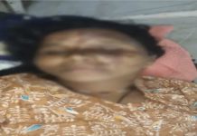 खेत में बरसी आसमानी आफत : तीन महिलाओं पर गिरी बिजली, एक की मौत, 2 गंभीर रूप से झुलसीं