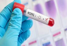 डेंगू के बाद अब स्वाइन फ्लू भी बरपा रहा कहर, इतनों की हुई मौत, तेजी से हो रहे लोग बीमार