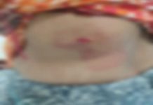 रायपुर में महिला कारोबारी पर चाकू से हुआ हमला, पुरानी रंजिश को लेकर युवक ने कि मारपीट