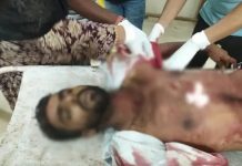 मनेंद्रगढ़ में युवक पर चाकू से हुआ ताबड़तोड़ हमला, इलाज के दौरान मौत